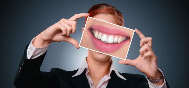 Hoe lang blijft het bleakresultaat zichtbaar - informatie over duurzaamheid van tandbleaching en factoren die het resultaat b